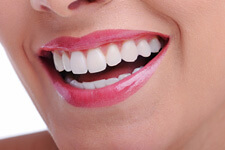 Close up of woman's mouth smiling with very white teeth