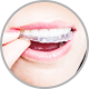 Close up of woman smiling putting on clear teeth aligners